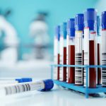 Module 2 – HIV Testing and Counseling